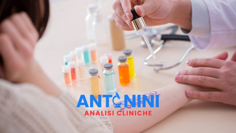 Test allergie e intolleranze Roma